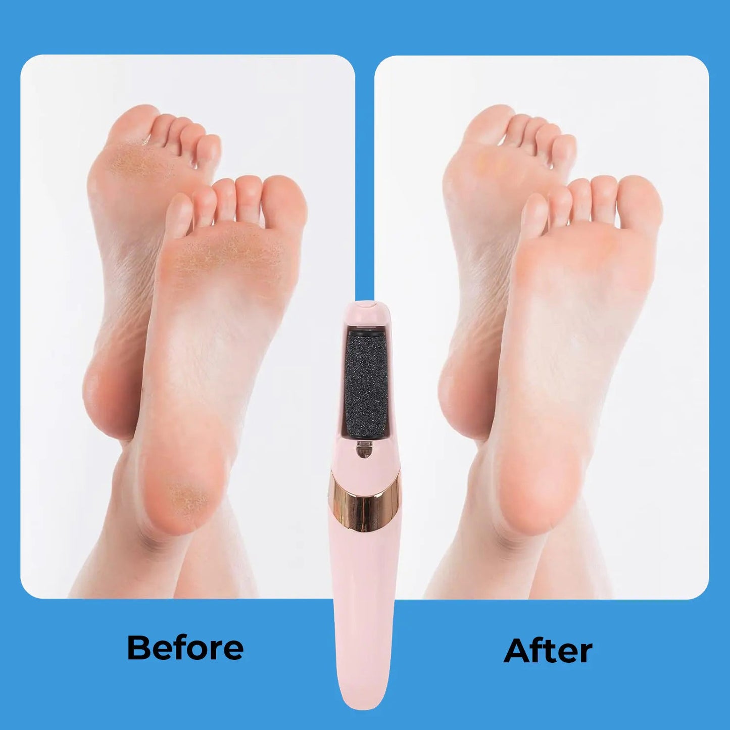 Electric Callus Remover for Feet